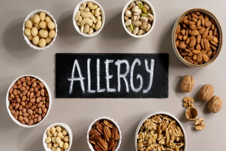 Allergies alimentaires et gastronomie : comment se régaler sans compromis ?